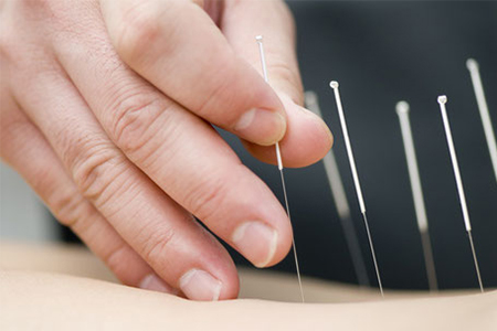 https://chooselifewellness.com/wp-content/uploads/2015/11/Acupuncture.jpg